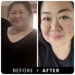 LifeRx.md before and after result