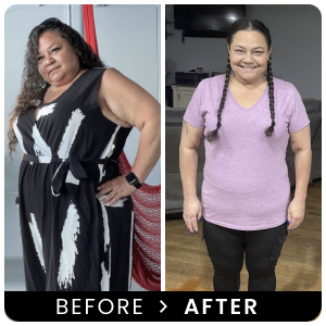 LifeRx.md before and after result