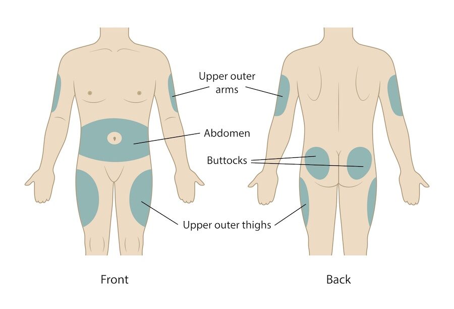 sites for injecting GLP-1